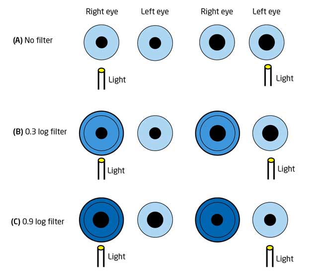 boa eye pupil size meaning