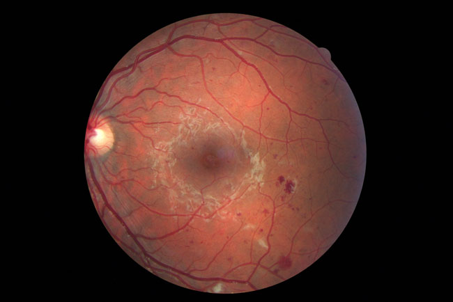 Rm Retinal - Optician